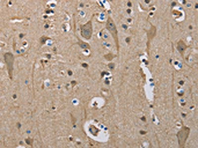 SERPINA1 Antibody