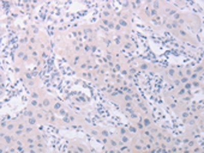 PKD2L1 Antibody