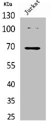Acetyl-XRCC6 (K542) Antibody