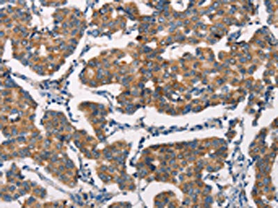 SPR Antibody