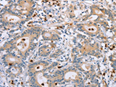KLK4 Antibody