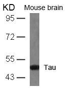 MAPT (Ab-404) Antibody
