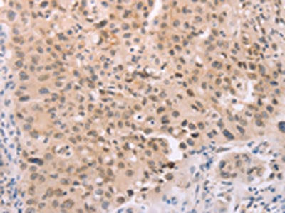 ADAM11 Antibody