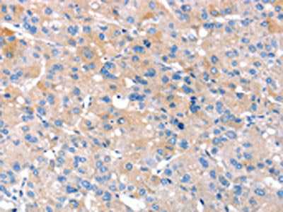 RNF214 Antibody