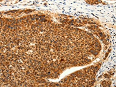 TRPC6 Antibody
