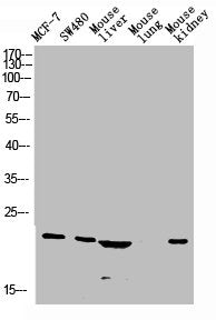 CALCA Antibody