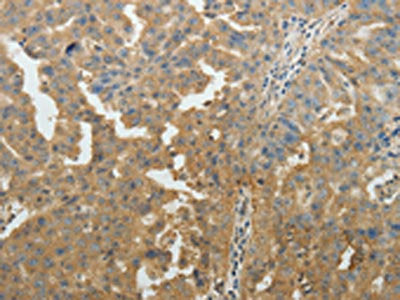 SYT6 Antibody