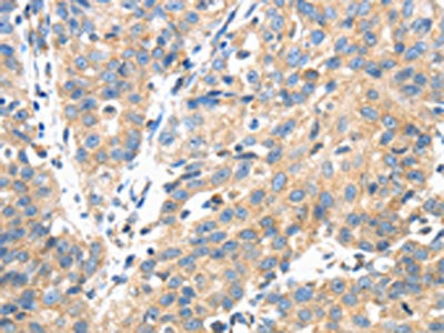 TSC2 Antibody