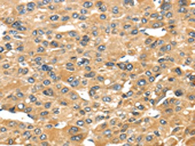 UCP1 Antibody