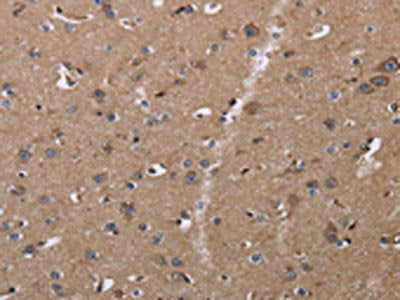 CLDN23 Antibody