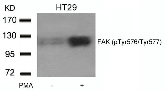 Phospho-PTK2 (Tyr576/Tyr577) Antibody