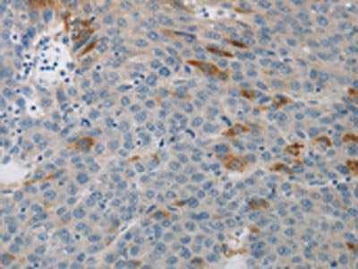 MCMBP Antibody