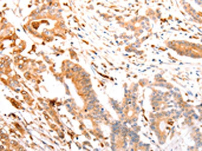 ABCA4 Antibody