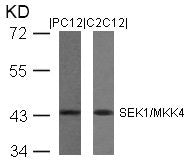 MAP2K4 (Ab-80) Antibody