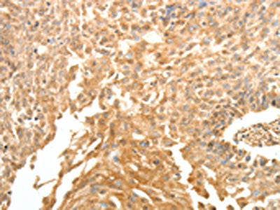 SYT6 Antibody