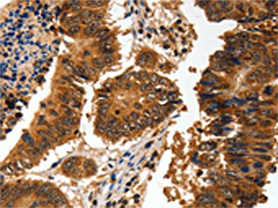 ADAP1 Antibody
