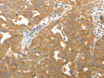 MAP1B Antibody
