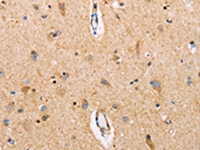 CTNNA1 Antibody