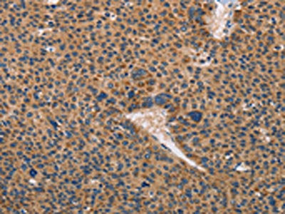 TLR3 Antibody