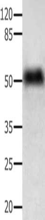 ACTG1 Antibody