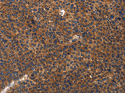 ITGB3 Antibody
