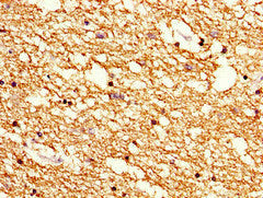 CNP Antibody