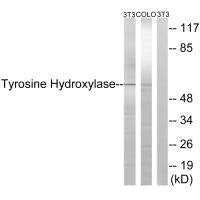 TH (Ab-19) Antibody