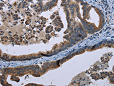 MARK4 Antibody
