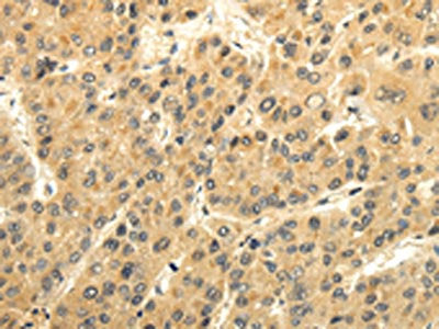 GAD1 Antibody