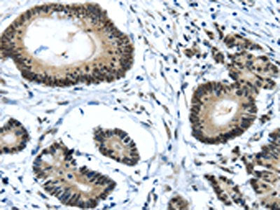 MED4 Antibody