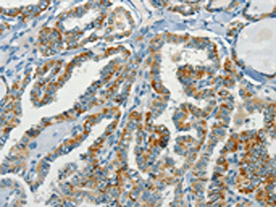 NPAP1 Antibody