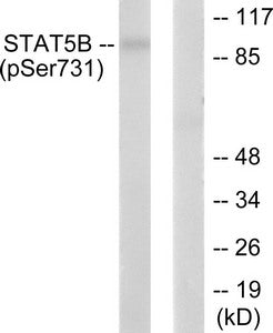 Phospho-STAT5B (Ser731) Antibody