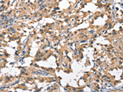 HGF Antibody