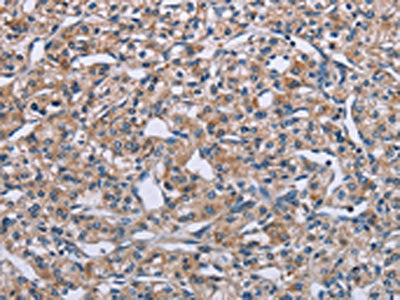 PLXNA2 Antibody