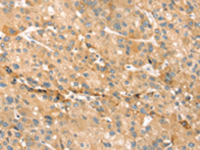 EVA1A Antibody