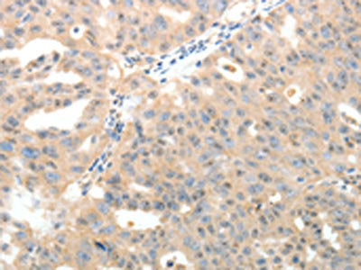 LRP12 Antibody