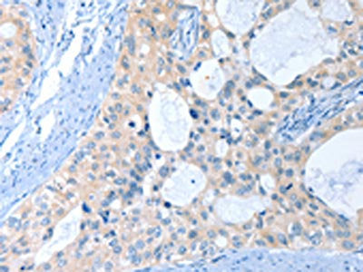 ANKRD54 Antibody