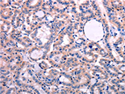 LEP Antibody