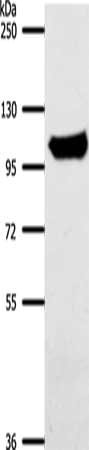 ACO1 Antibody