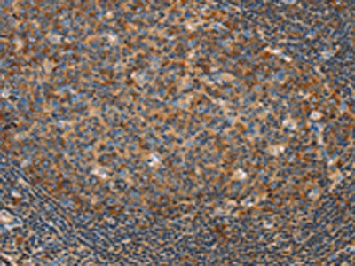 CAMK4 Antibody