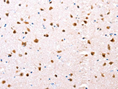 ESR1 Antibody