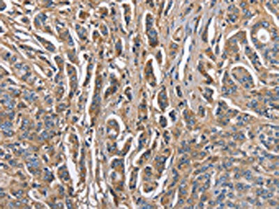 ABI3BP Antibody