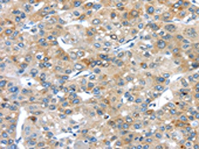 PLXNA3 Antibody