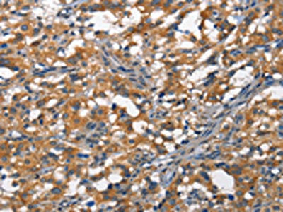 DDR2 Antibody