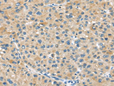 ABCC2 Antibody
