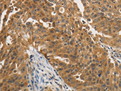 PTPN11 Antibody