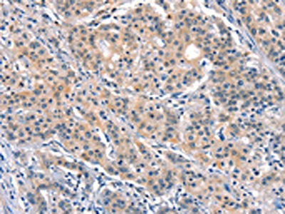 ELOVL6 Antibody