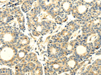 WDR91 Antibody