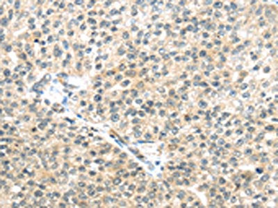 TTBK2 Antibody