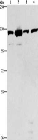 PTK2 Antibody